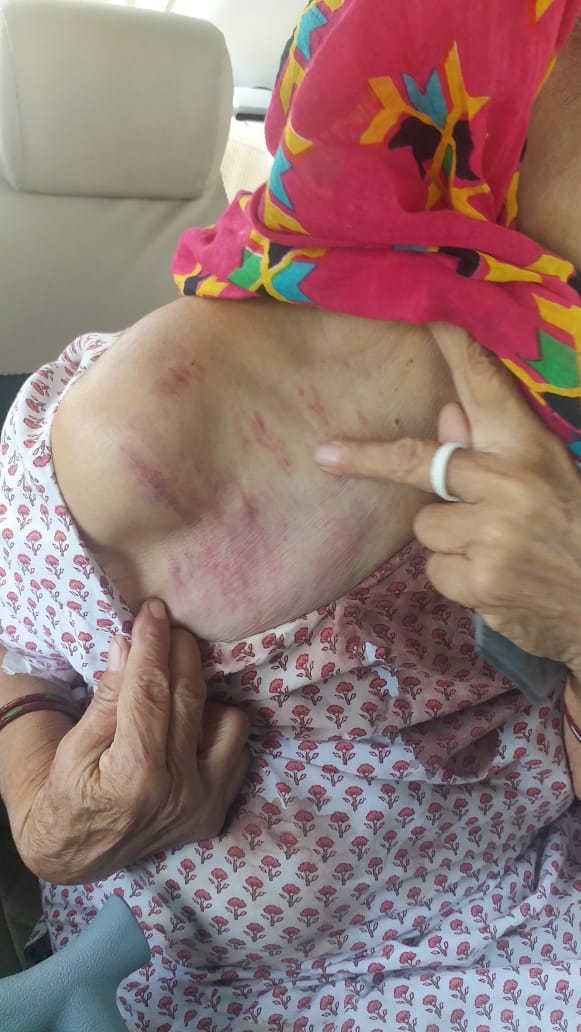 A daughter-in-law descended on cruelty, an old woman was assaulted