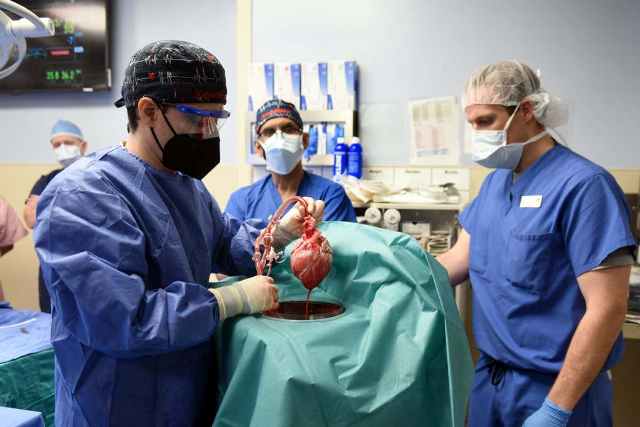 A revolutionary experiment (Pig's Heart Experiment) completed its first 10 days yesterday (18 January 2022). 57-year-old man who had a pig's heart transplant in his body